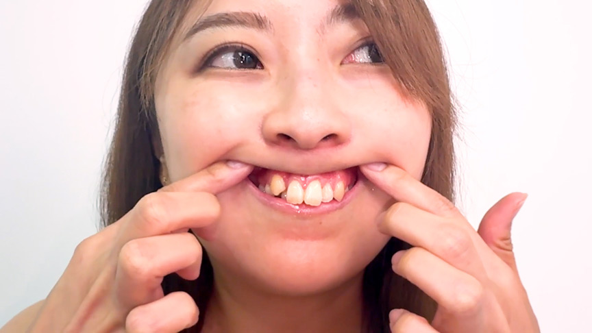食いしん坊なのに口内美人！弓山ゆきちゃんの口内観察 003